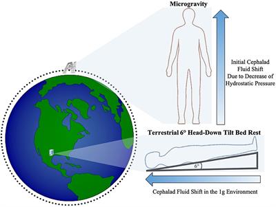 Head-Down Tilt Bed Rest Studies as a Terrestrial Analog for Spaceflight Associated Neuro-Ocular Syndrome